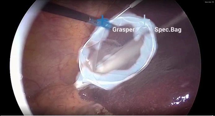 Endoscopy video with GPU-powered tool-tracking overlays